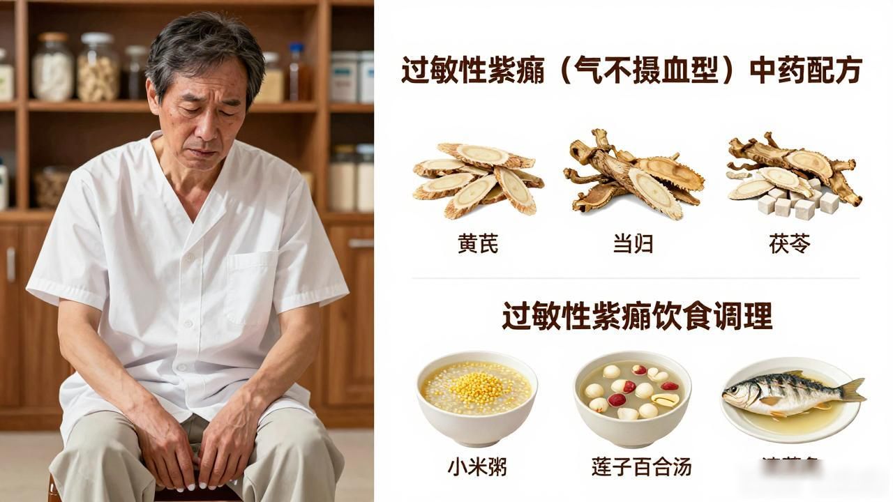 过敏性紫癜别乱吃!中药配方+饮食调理,止血化瘀快