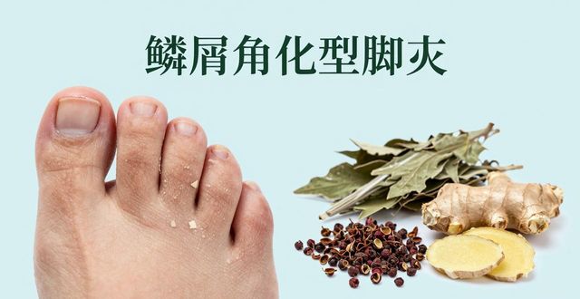 夏天脚趾缝痒有怪味？可能是脚气！教你中药泡脚配方搞定