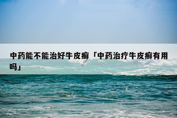 中药能不能治好牛皮癣「中药治疗牛皮癣有用吗」
