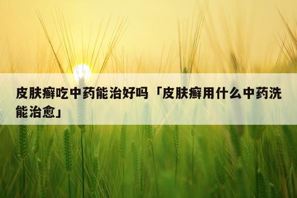 皮肤癣吃中药能治好吗「皮肤癣用什么中药洗能治愈」