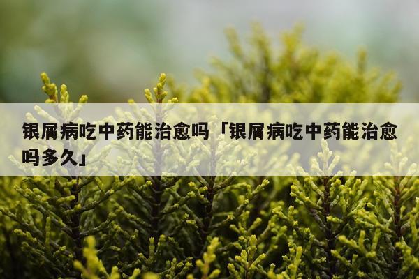 银屑病吃中药能治愈吗「银屑病吃中药能治愈吗多久」
